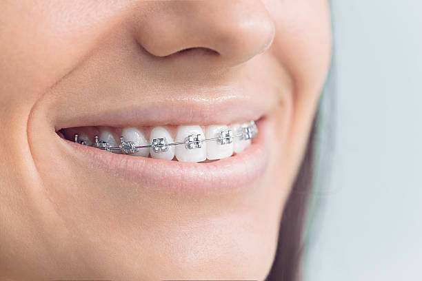 Best Veneers and Lumineers  in Pleasant Hills, PA