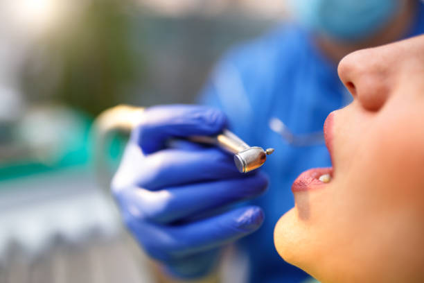 Dental Bonding in Pleasant Hills, PA